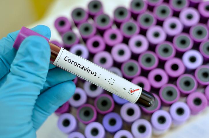 Se confirmó el primer caso positivo de coronavirus en Venado Tuerto